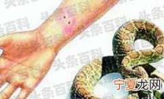 梦见在水里被蛇咬是什么意思 梦到在水里被蛇咬是什么预兆