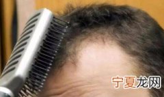 防脱发的方法 预防脱发的几个小妙招