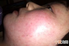 经常过敏怎么办