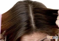 为什么会有头皮屑很大块 为什么会有头皮屑