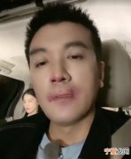 脸打肿了怎么办，今天和男朋友打架扇他的脸记不清打了多少下觉得自己的手都