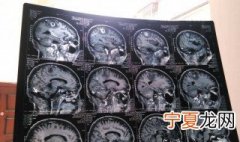 有什么方法可以调节大脑 调节大脑的方法