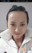 额头高怎么办，宝宝额头高怎么办是什么原因