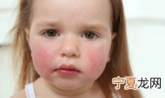 小孩受惊吓怎么办 小孩受惊吓的方法