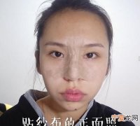 隆鼻失败怎么办