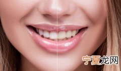 怎么把牙齿变白 牙齿变白的方法