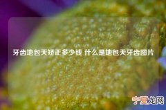 牙齿地包天矫正多少钱 什么是地包天牙齿图片