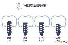 牙治疗一般多少钱 牙治疗多少钱一颗