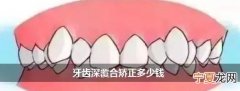 牙齿深覆合矫正多少钱 牙齿深覆合矫正大概要花费多少钱