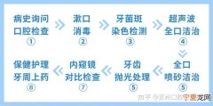 昆明洗牙多少钱 昆明洗牙多少钱一次