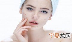 鼻子痘痘是什么原因 鼻子痘痘原因解析