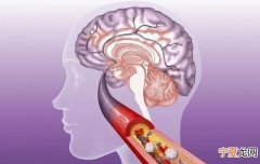 脑血栓患者吃什么食物恢复最好 脑血栓了患者吃什么食物比较好