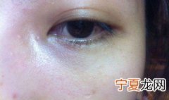 脸上脂肪粒怎么去除小窍门 脸上脂肪粒去除小窍门介绍