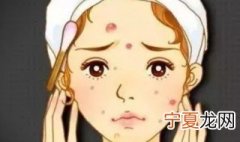 脸上痘印如何祛除 祛除痘印方法
