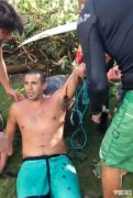 美国男子在夏威夷滑浪期间遭鲨鱼咬伤手脚