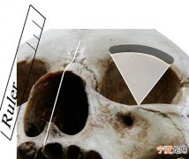 新研究揭示世界主要人群骨性眼眶形状特点和差异